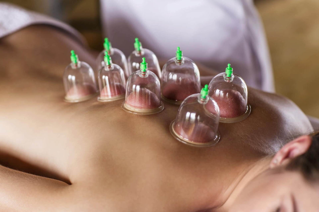 Cuppingmassage, wat is het? - Intertaping.nl